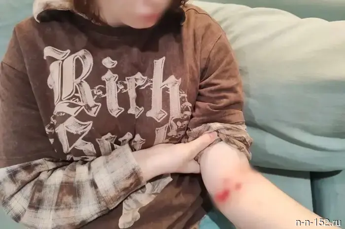 A dog attack on a 13-year-old girl in Bor has led to an investigation by the Investigative Committee.