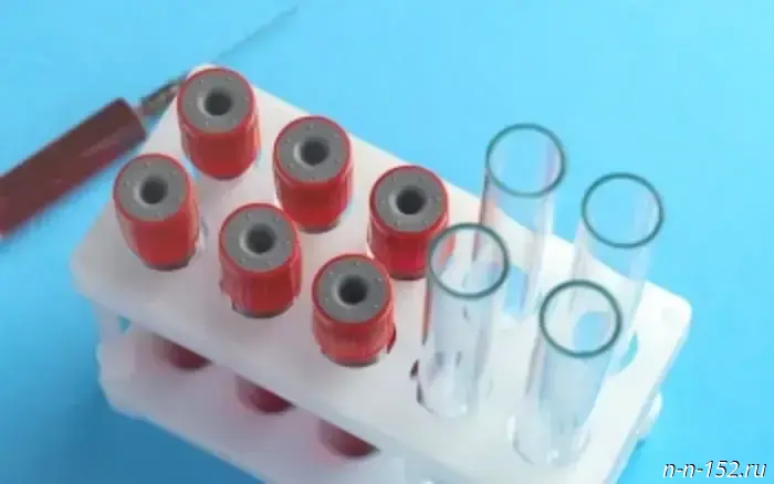 On the diagnosis and prevention of HIV infection