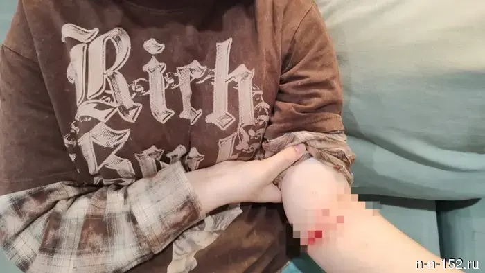 A dog bit a 13-year-old child in the city of Bor.
