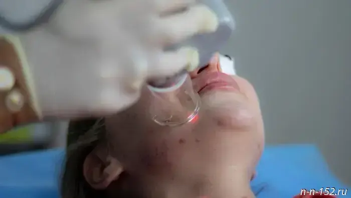 A dermatologist from Nizhny Novgorod explained why the "superfungus" from Europe is dangerous.