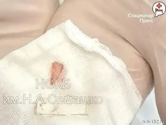 В теплице произошел инцидент: осколок стекла застрял в шее у жительницы Нижнего Новгорода.